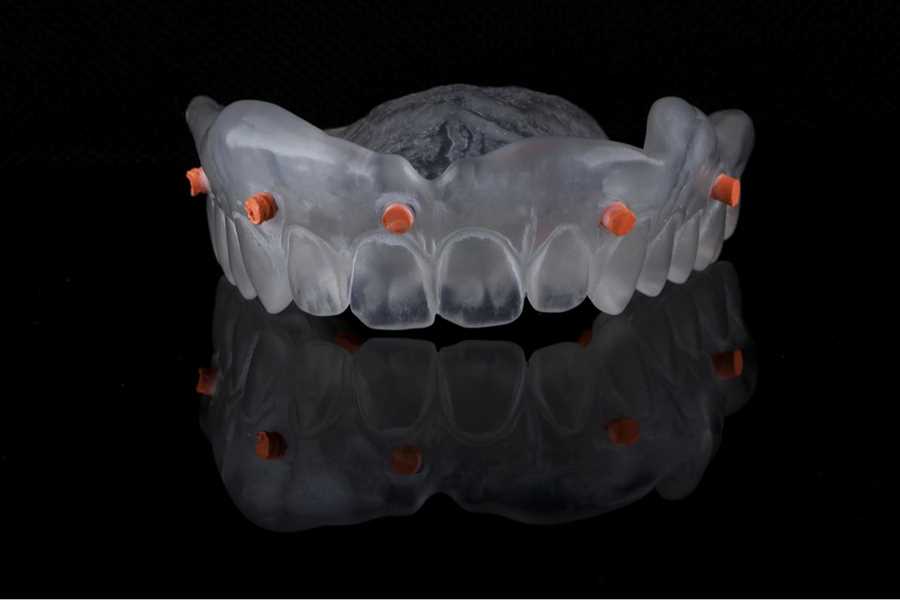 Revolutionizing Orthodontics: The Power of Digital Impressions for Braces