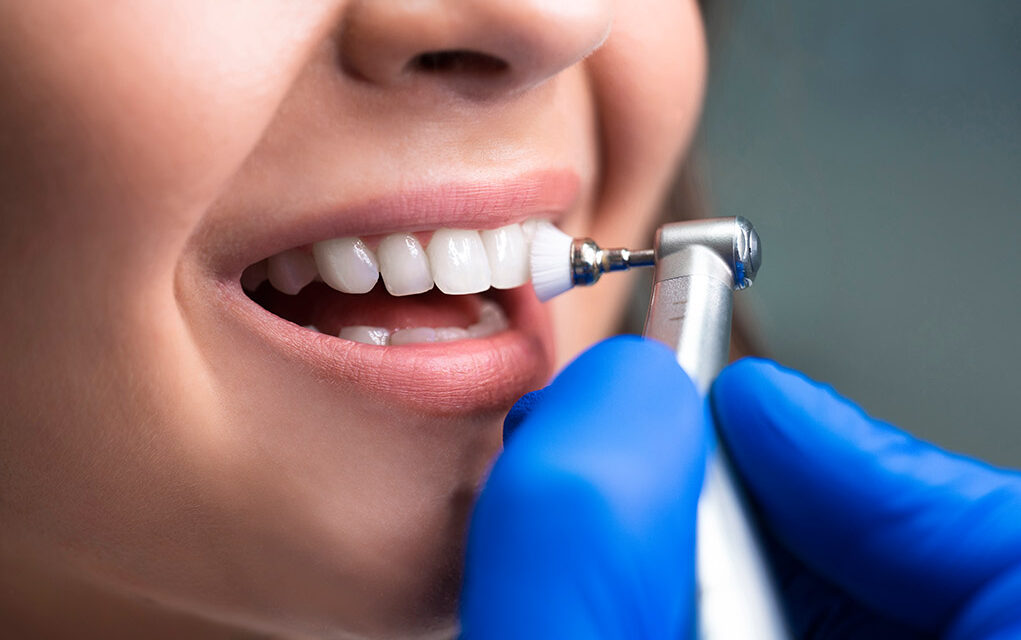 The Benefits of Regular Professional Teeth Cleanings