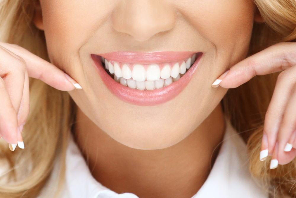 Transform Your Smile with a Smile Makeover